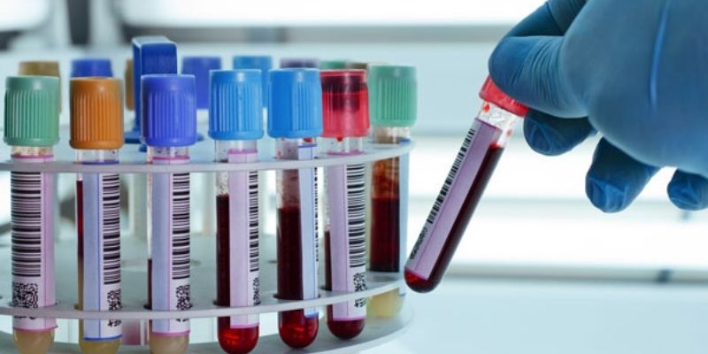 Voici un moyen simple pour tester votre santé