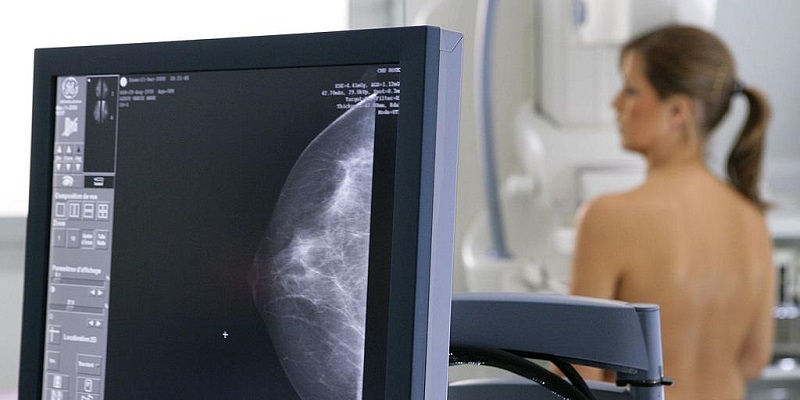 Cancer du sein : un nouveau traitement plus efficace disponible