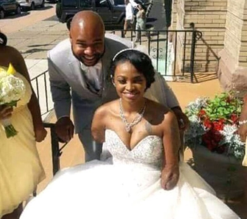 Par amour, il épouse une femme sans mains ni jambes (photos)