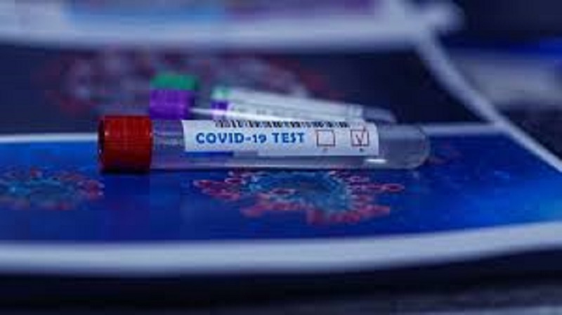Covid-19 : l’UEMOA fixe le prix des tests PCR pour les voyageurs