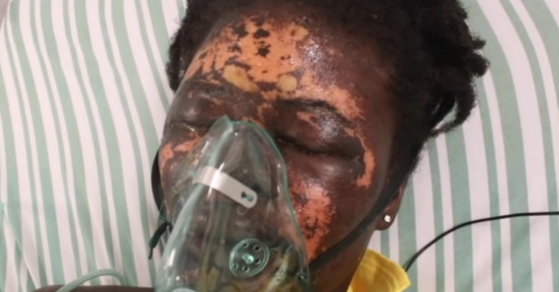 Ghana : un homme verse de l’acide sur sa femme (vidéo) 