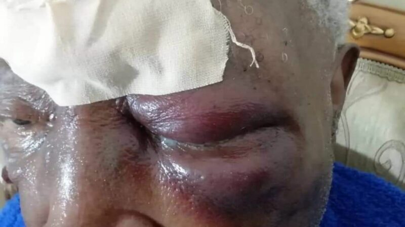 Togo / Photo ensanglantée de Mgr Kpodzro : on en sait un peu plus