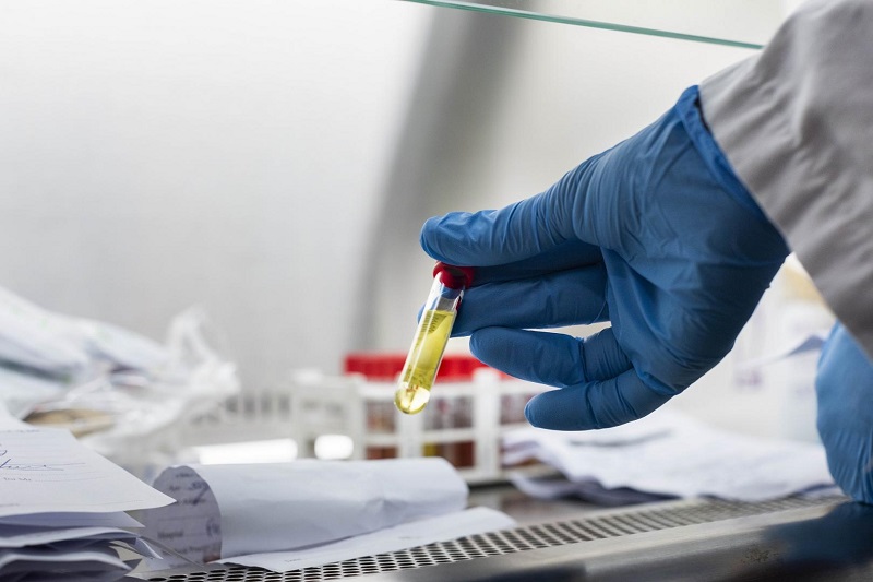 Togo : Démarrage effectif du traitement contre des maladies parasitaires