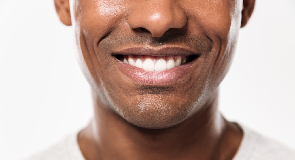 Astuces : Comment blanchir ses dents naturellement