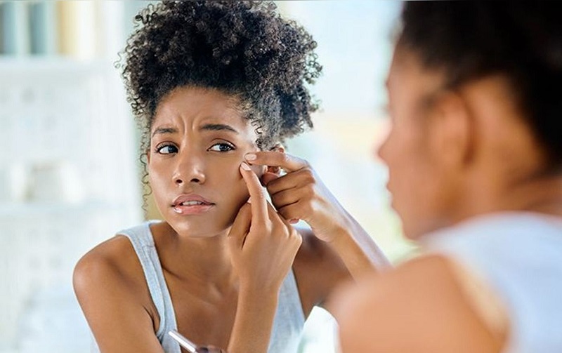 Voici 5 choses bizarres qui traitent l’acné et les boutons