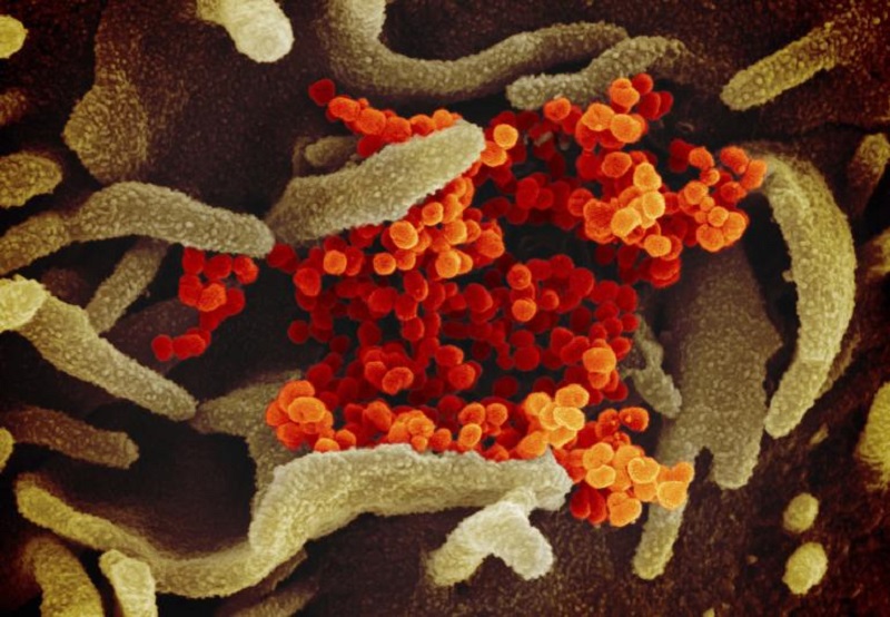 Coronavirus : Pourquoi peut-on attraper le Covid-19 plusieurs fois ?