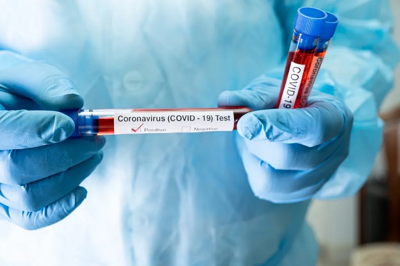 Covid-19 : Ce groupe sanguin favoriserait la contamination