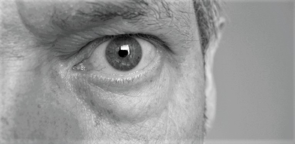 5 meilleures façons de traiter les poches sous les yeux à la maison