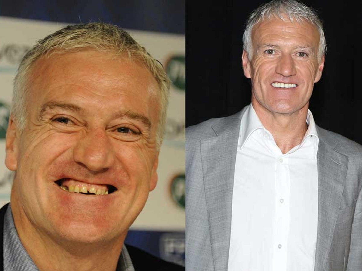 Didier Deschamps : le montant fou dépensé par le coach pour se refaire les dents fuite sur la toile