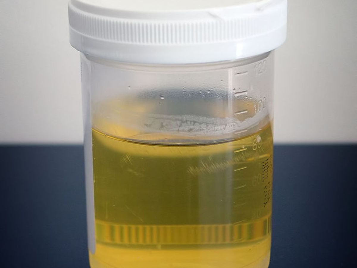 Du sang menstruel comme engrais, de l’urine comme répulsif : voici des astuces 100% naturelles mais peu ragoûtantes