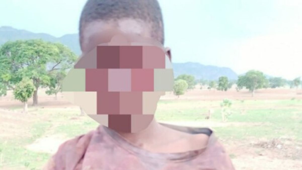 Les yeux d’un garçon de 16 ans arrachés par son « employeur » (photo)
