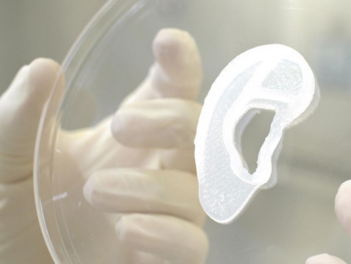 Science : La toute première oreille imprimée en 3D a été greffée sur un humain