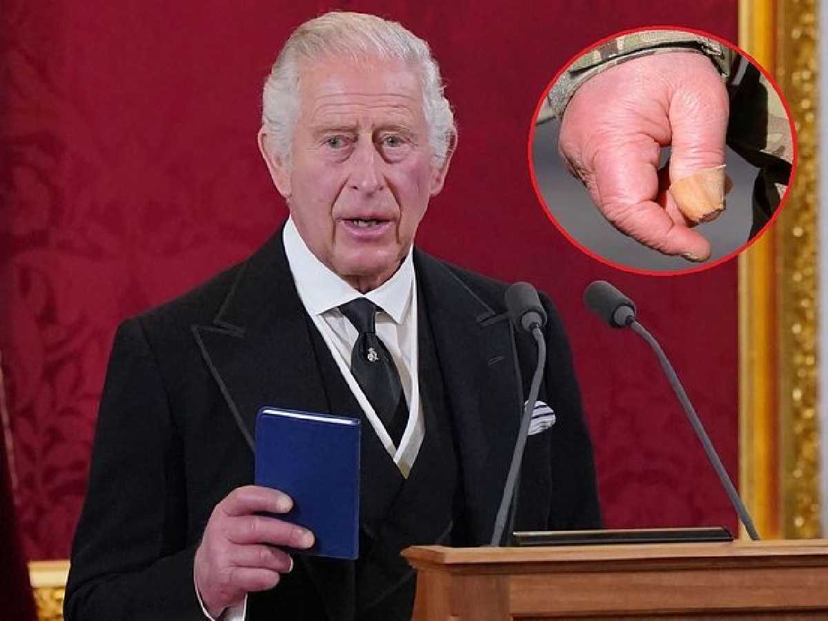 “On dirait des saucisses” : les doigts étrangement rouges et gonflés du Roi Charles III attirent l’attention