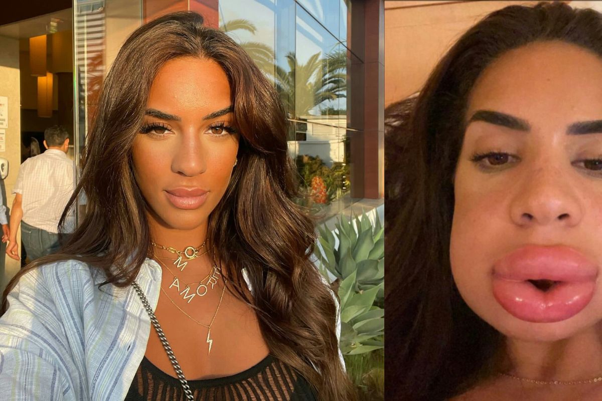 Marwa Merazka méconnaissable : les lèvres ultra gonflées de la star scandalisent la toile (vidéo)