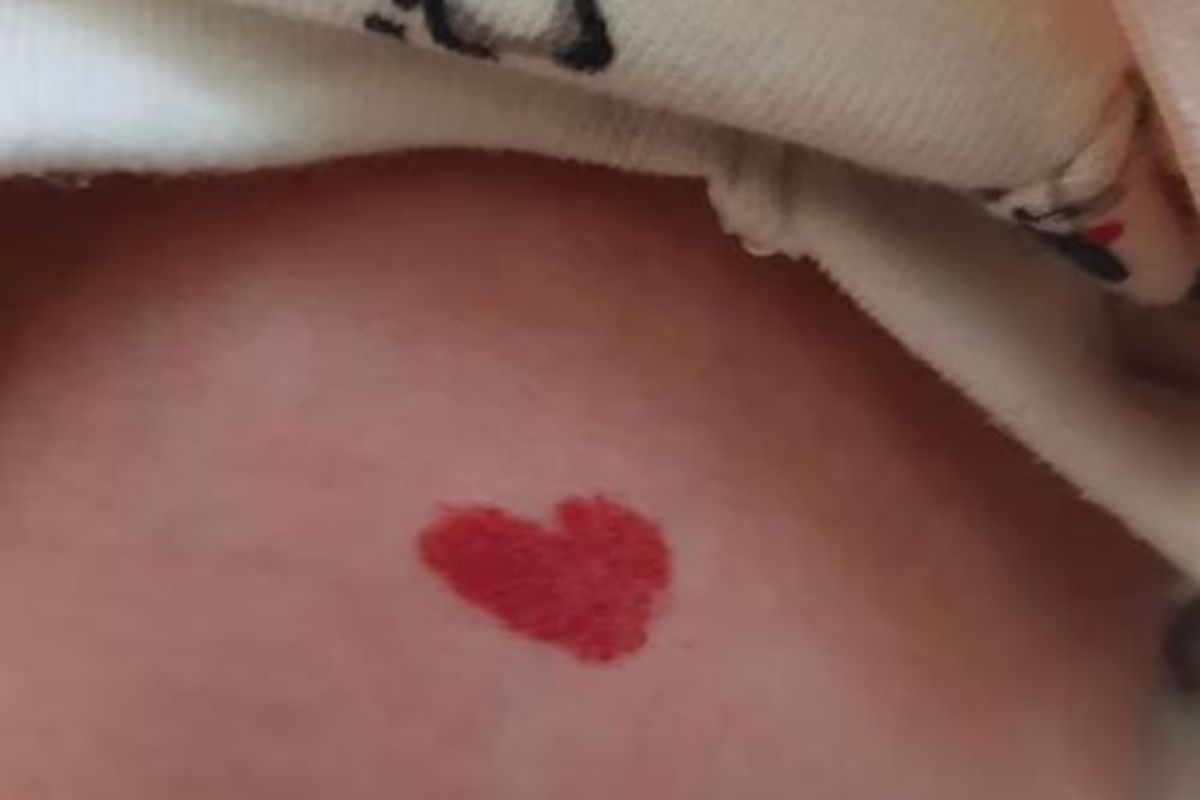 enfant tache de naissance cœur