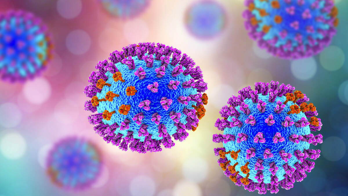 Rwanda : un virus lié à Ebola refait surface et fait des décès