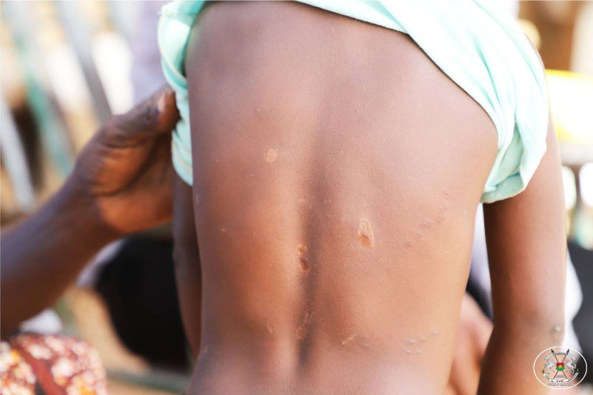 Côte d’Ivoire/Violences faites aux enfants : la triste histoire d’Innocente, une fillette de 3 ans bouleverse la toile